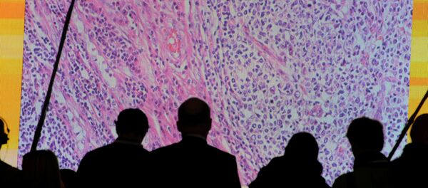 خلية سرطانية - سبوتنيك عربي