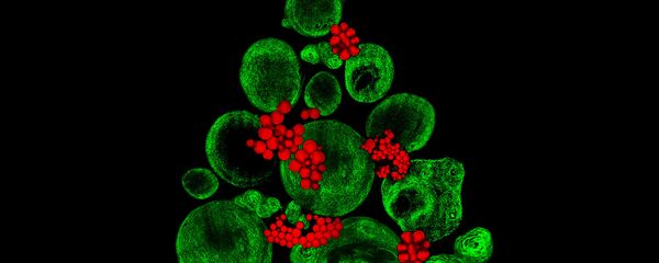 صورة لزراعة أنسجة غضروفية في مختبر باستخدام خلايا جذعية عظمية، والصورة مكبرة 20 و40 مرة - حائزة على المرتبة الـ 9، المملكة المتحدة - سبوتنيك عربي