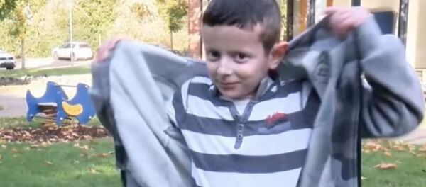 زراعة جلد لطفل - سبوتنيك عربي