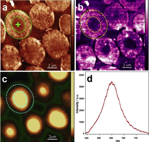   بيانات التحليل الابتكاري المنسع, من مدمج اساليب  3 D الذي يمسح ضوئيا شعاعيا و عدسيا مجهريا - سبوتنيك عربي