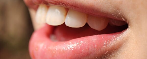 أسنان - سبوتنيك عربي