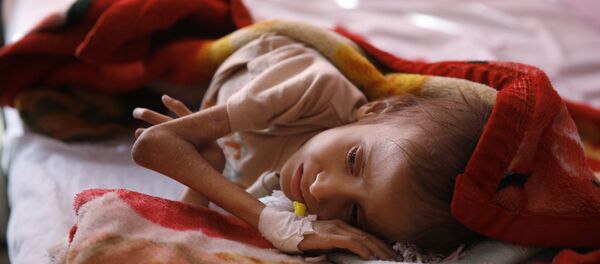 كارثة اليمن - سبوتنيك عربي