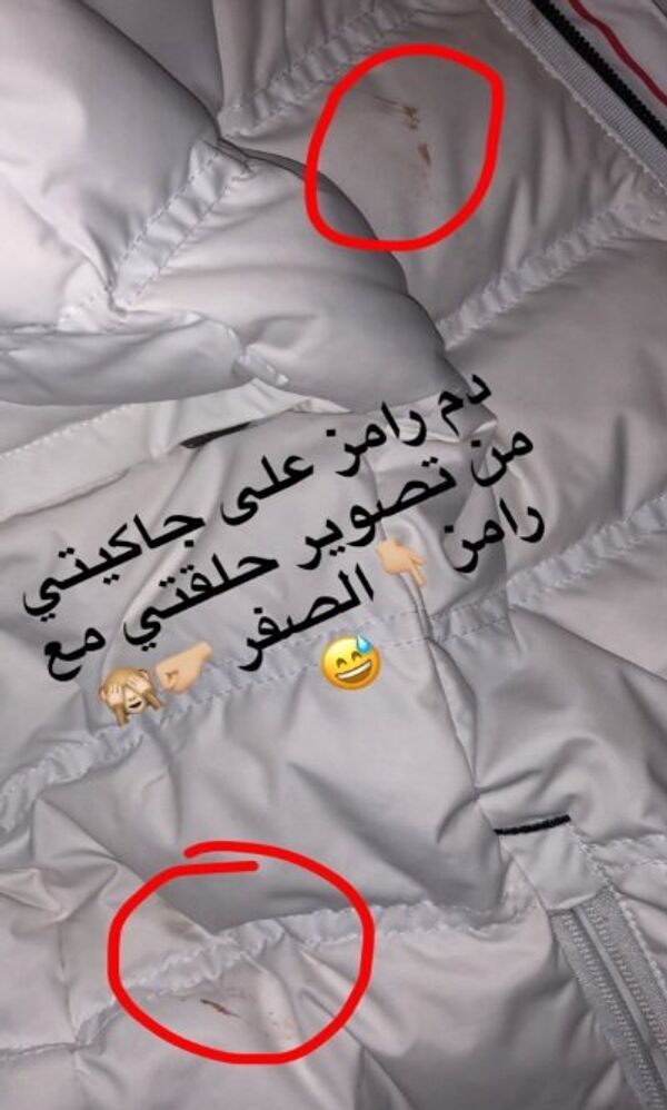 دماء رامز جلال على معط ديانا حداد في برنامج رامز تحت الصفر - سبوتنيك عربي