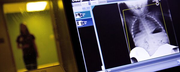 أشعة سينية - سبوتنيك عربي