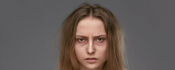 الهالات السوداء حول العين - سبوتنيك عربي