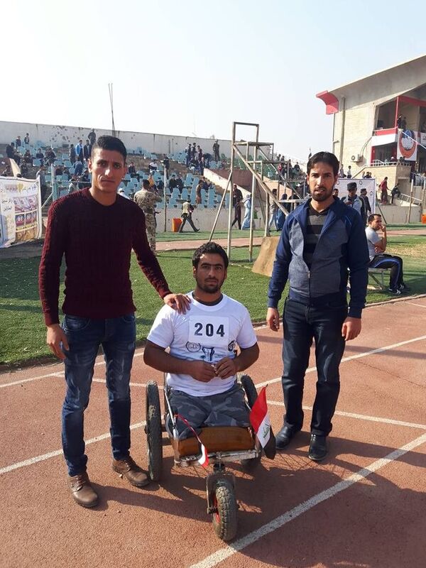 شاب عراقي بتر تنظيم داعش ساقه شاب عراقي بتر تنظيم داعش ساقه - سبوتنيك عربي