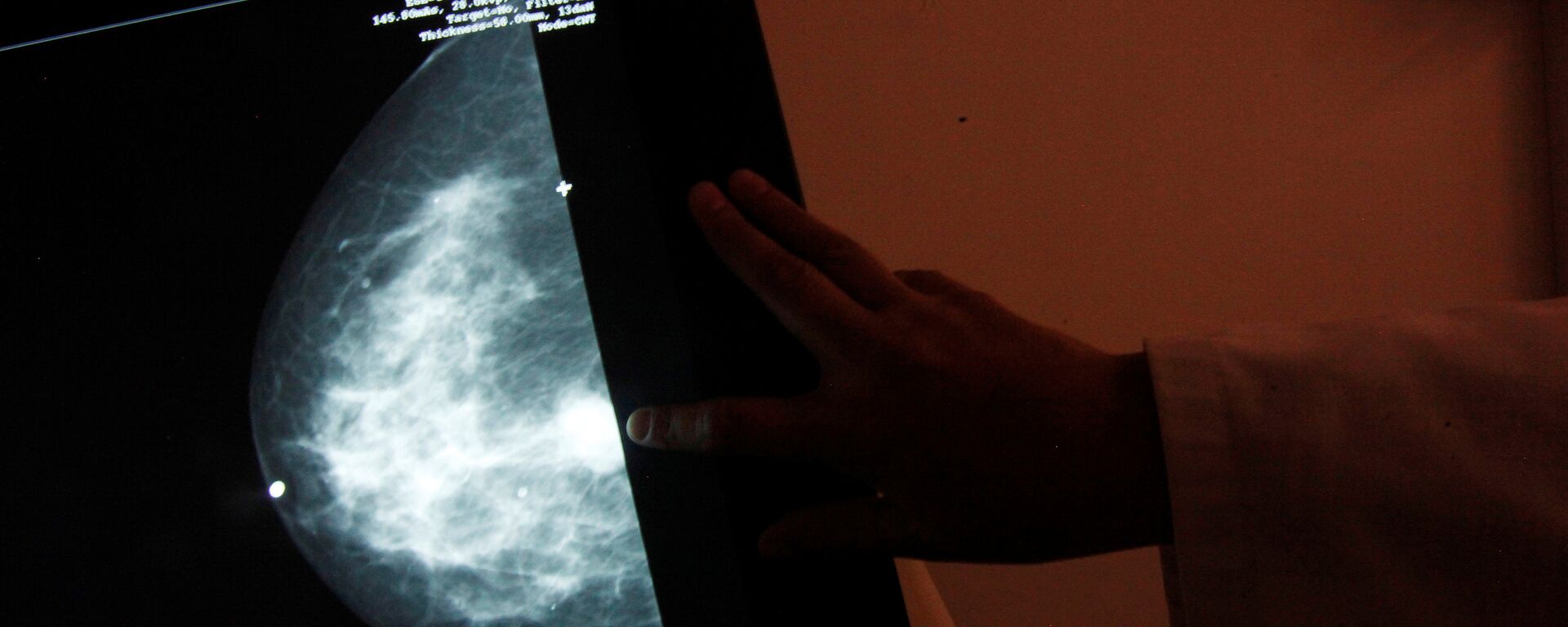 سرطان الثدي - سبوتنيك عربي, 1920, 27.10.2021