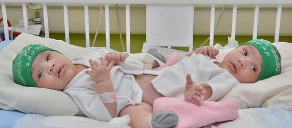 تجري السعودية عملية فصل التوأم السيامي رقم 46، في مستشفى الملك عبدالله التخصصي للأطفال بمدينة الرياض ، بعد تأجيلها الشهر الماضي لدواعي طبية. - سبوتنيك عربي