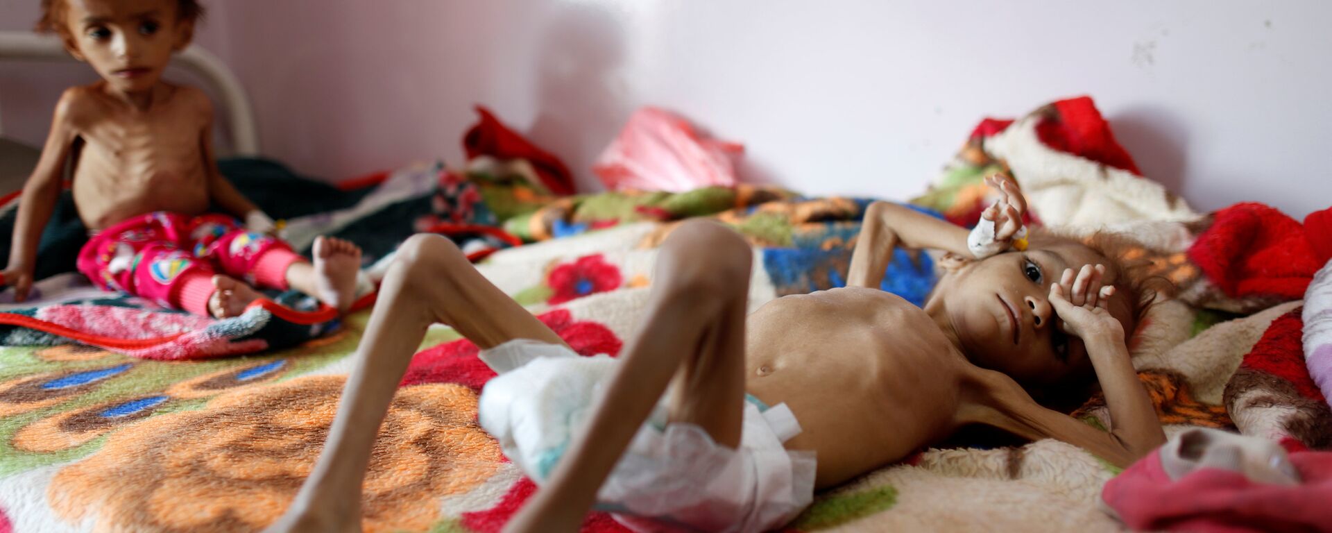 أطفال اليمن، المجاعة، 6 أكتوبر/ تشرين الأول 2018 - سبوتنيك عربي, 1920, 15.11.2021