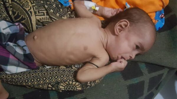 أطفال اليمن - سبوتنيك عربي