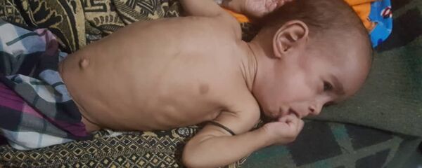 أطفال اليمن - سبوتنيك عربي