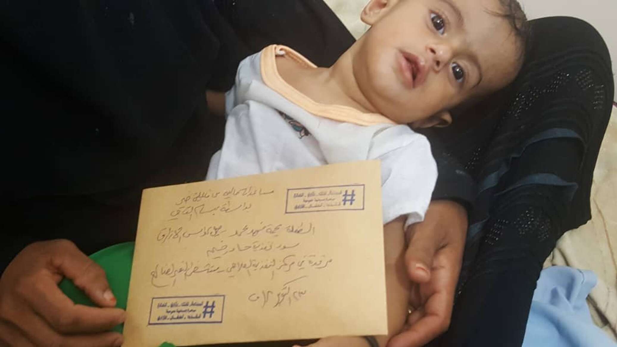 الأمم المتحدة: وفاة 39 ألف طفل في اليمن خلال العام الماضي بأمراض يمكن الوقاية منها
