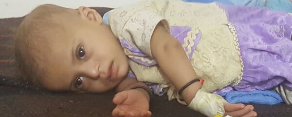 أطفال اليمن - سبوتنيك عربي