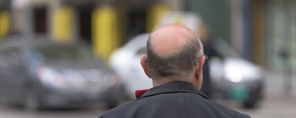 الصلع - سبوتنيك عربي