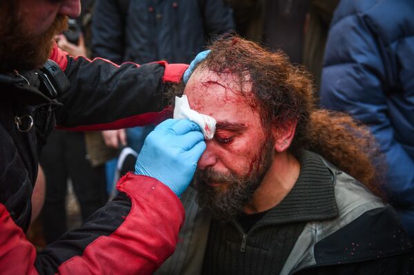 إصابة كوستيس دادميس مراسل سبوتنيك أثناء الاحتجاجات في أثينا - سبوتنيك عربي