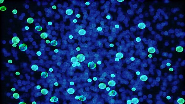 بكتريا - سبوتنيك عربي