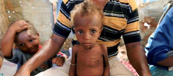 هناء أحمد علي بحر فتاة تعاني من سوء التغذية تجلس على حجر والدها في مدينة من الأكواخ في الحديدة باليمن - سبوتنيك عربي