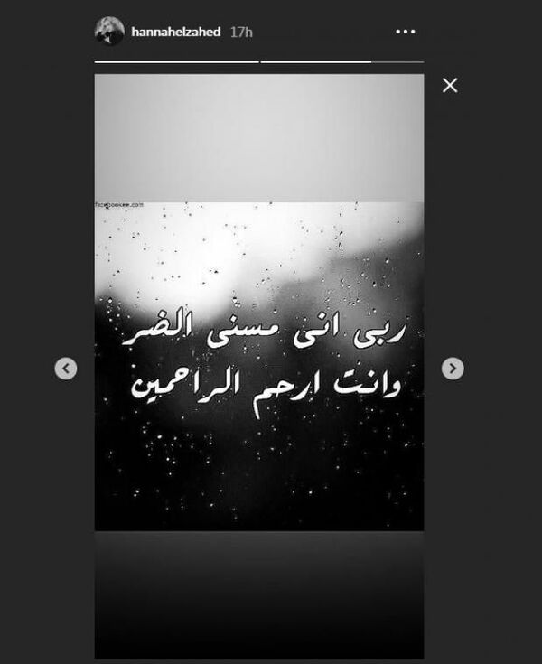 بالصور... أول تعليق للممثلة هنا الزاهد من داخل المستشفى - سبوتنيك عربي