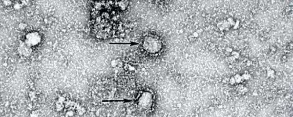 فيروس كورونا تحت المجهر - سبوتنيك عربي