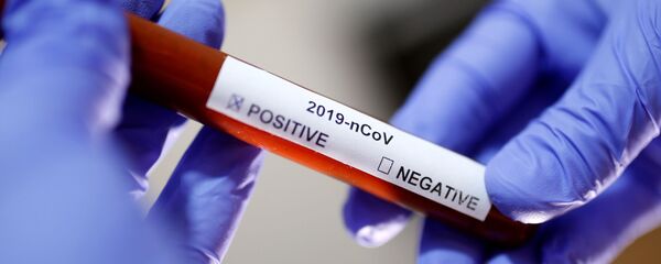 عينة دم تحمل فيروس كورونا - سبوتنيك عربي