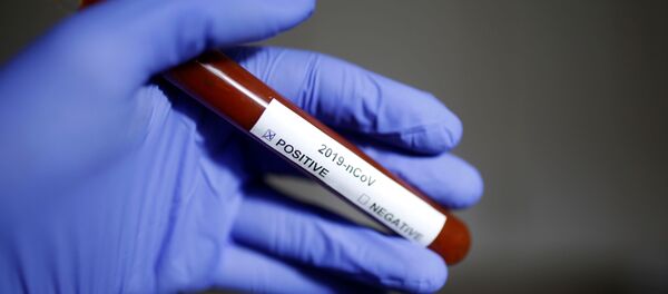 فيروس كورونا المستجد فيروس كورونا المستجد - سبوتنيك عربي