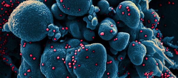 مسح إلكتروني مصغر لخلية في حالة استماتة (باللون الأزرق) مصابة بجزيئات من الفيروس SARS-COV-2 (باللون الأحمر)، والمعروفة أيضًا باسم كورونا، تم أخذها كعينة من مريض. تم التقاط الصورة في مركز للأبحاث في فورت ديتريك بولاية ماريلاند الأمريكية. - سبوتنيك عربي