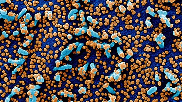 مسح إلكتروني مصغر لخلية فيرو (خلايا توجد في الكلى، باللون الأزرق) مصابة بجزيئات من الفيروس SARS-COV-2 (باللون البرتقالي)، والمعروفة أيضًا باسم كورونا، تم أخذها كعينة من مريض. تم التقاط الصورة في مركز للأبحاث في فورت ديتريك بولاية ماريلاند الأمريكية. - سبوتنيك عربي