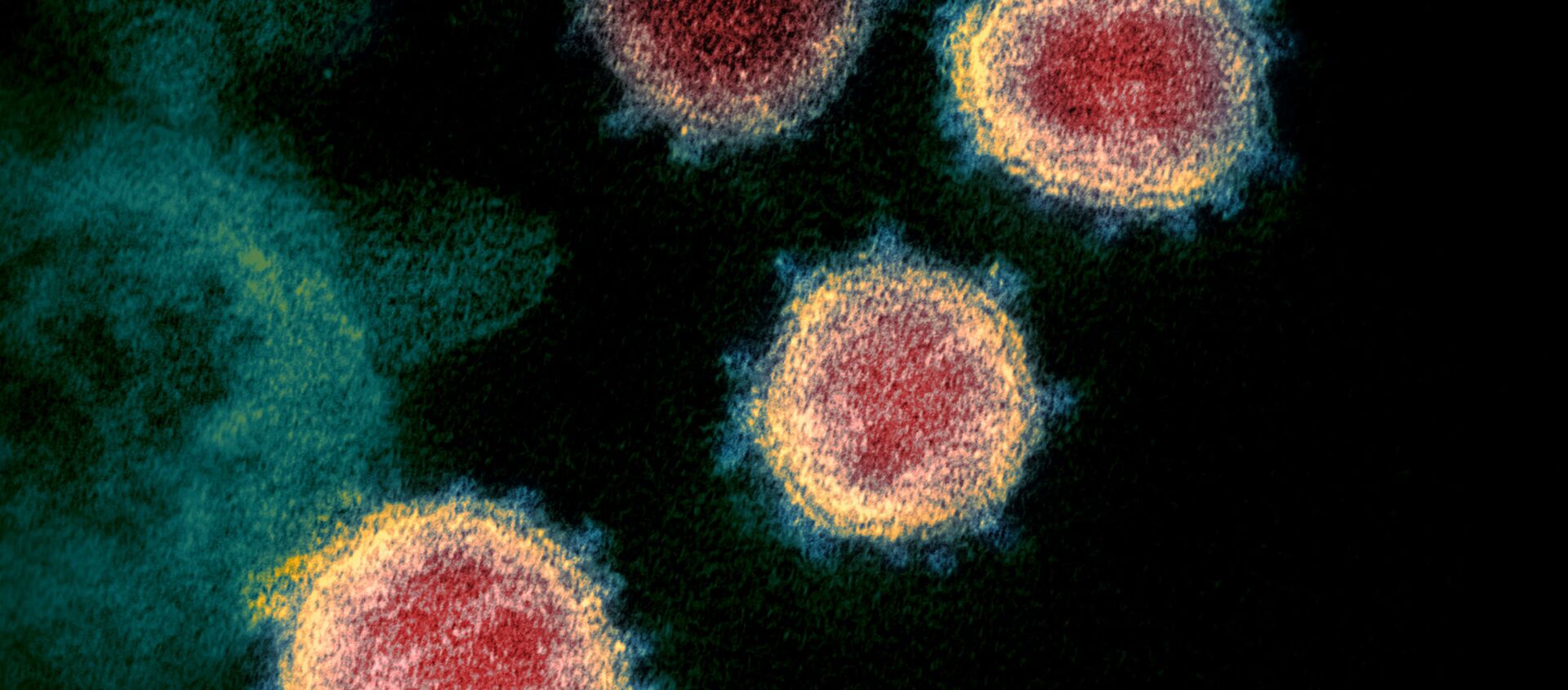 تُظهر صورة المجهر الإلكتروني لفيروس SARS-CoV-2، والمعروف أيضًا باسم الفيروس التاجي الجديد كورونا، الذي يسبب مرض فيروسي COVID-19، المعزول من مريض في الولايات المتحدة. وتظهر على الخلايا نتوءات صغيرة خارج سطح الخلايا فتبدو كتاج. - سبوتنيك عربي, 1920, 22.06.2021