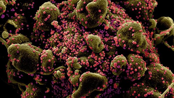 مسح إلكتروني لخلية في حالة الاستماتة (باللون البني المخضر) لمريض مصاب جداً بجزيئات فيروس SARS-COV-2 (باللون الوردي)، والمعروف أيضًا باسم فيروس تاجي جديد كورونا. - سبوتنيك عربي