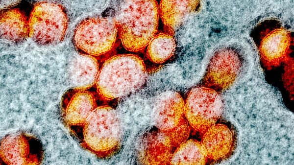صورة مجهرية إلكترونية لعينة من مريض، لجزيئات فيروس SARS-COV-2، والمعروفة أيضًا باسم الفيروس التاجي الجديد كورونا، الفيروس الذي يسبب مرض Covid-19. - سبوتنيك عربي