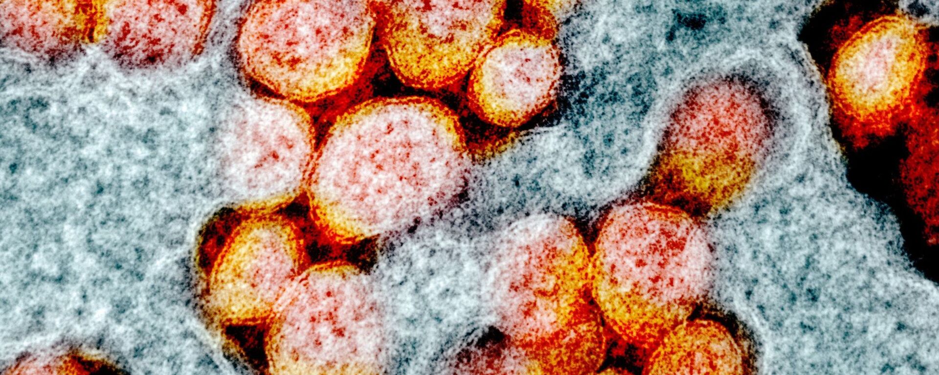 صورة مجهرية إلكترونية لعينة من مريض، لجزيئات فيروس SARS-COV-2، والمعروفة أيضًا باسم الفيروس التاجي الجديد كورونا، الفيروس الذي يسبب مرض Covid-19. - سبوتنيك عربي, 1920, 30.03.2021