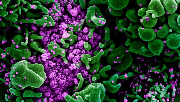 مسح إلكتروني لخلية في حالة الاستماتة (باللون الأخضر) لمريض مصاب جداً بجزيئات فيروس SARS-COV-2 (باللون البنفسجي)، والمعروف أيضًا باسم فيروس تاجي جديد كورونا. - سبوتنيك عربي