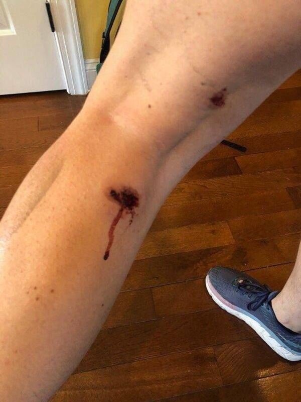 إصابة مراسلة سبوتنيك بعد تعرضها لرصاص الشرطة الأمريكية في محيط البيت الأبيض.. فيديو - سبوتنيك عربي