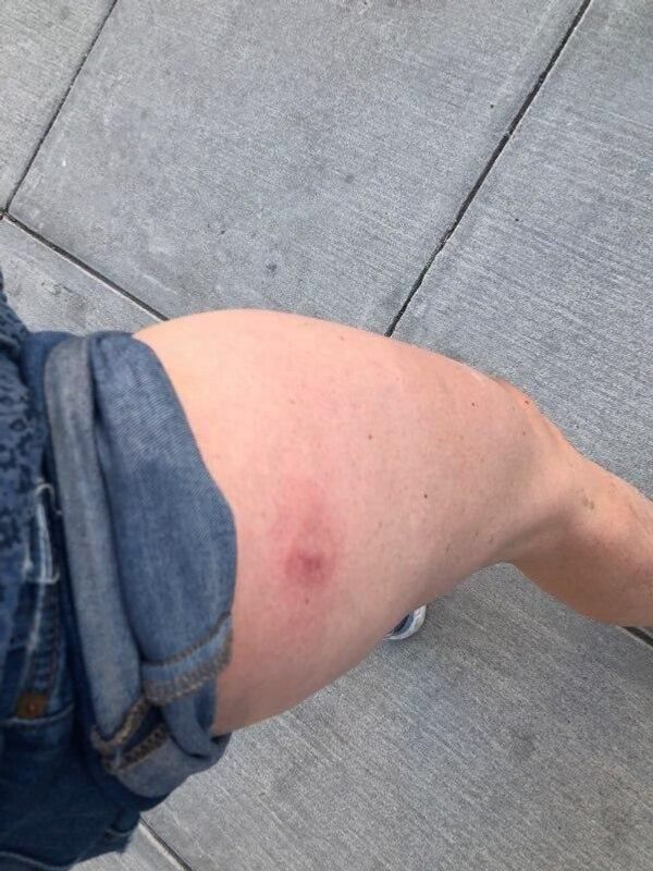 إصابة مراسلة سبوتنيك بعد تعرضها لرصاص الشرطة الأمريكية في محيط البيت الأبيض.. فيديو - سبوتنيك عربي