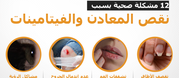 12 مشكلة صحية بسبب نقص المعادن والفيتامينات - سبوتنيك عربي